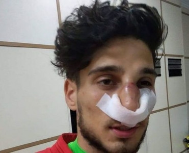 Mahir Mədətov qapıçının burnunu sındırdı - VİDEO