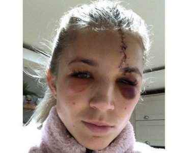 Komanda yoldaşı ilə toqquşdu, bu hala düşdü - FOTO