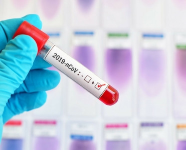 Premyer Liqamızın klubları yenidən koronavirus testindən keçəcəklər