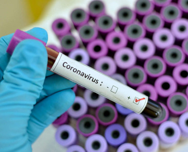 Koronavirus: 403 yoluxma qeydə alınıb, 3 nəfər vəfat edib