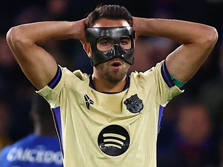 "Hər bir qolumuzun ləğv edilə biləcəyini hiss edirik"